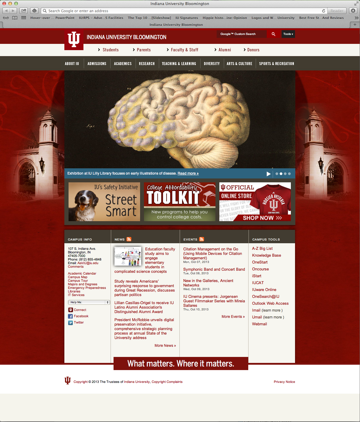 IUB Homepage Feature on Lilly Visualizing Disease Exhibition