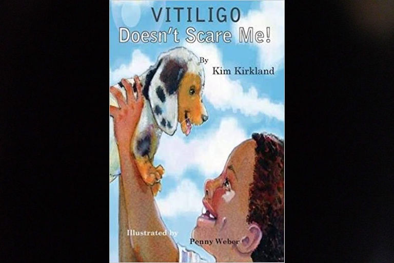 Vitiligo Doesn't Scare Me by Kim Kirkland.